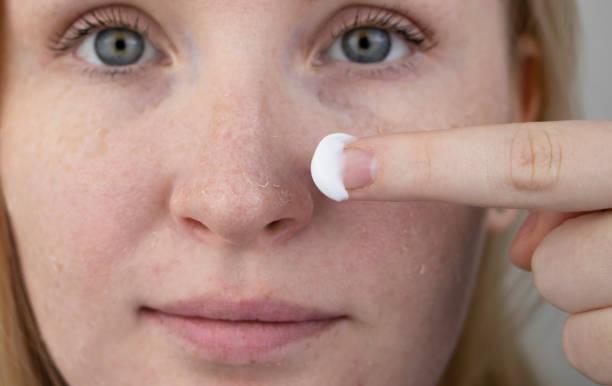 face dry skin